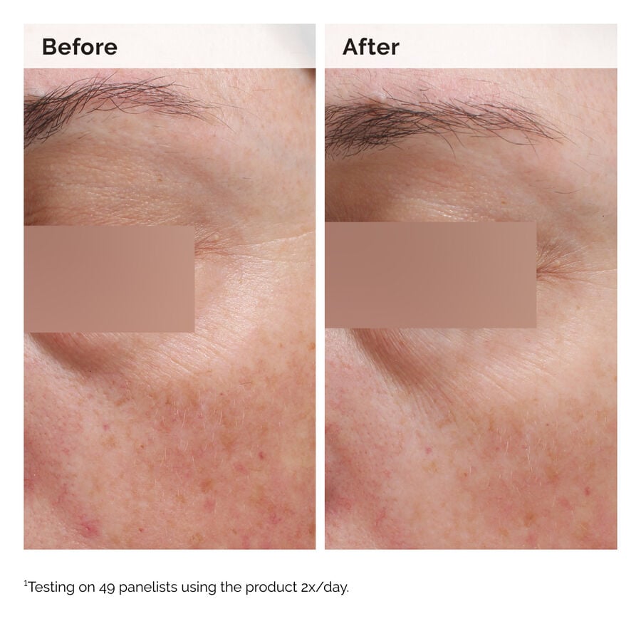 Niacinamide 5% Face and Body Tone-Evening Emulsion