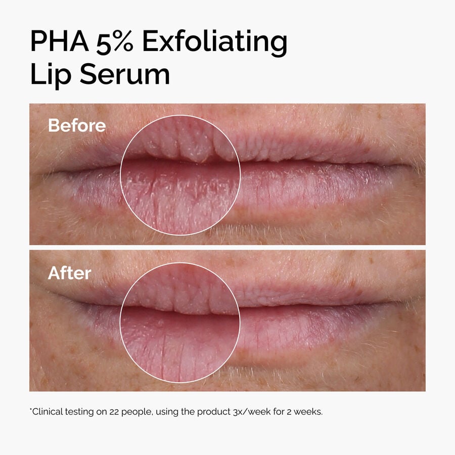 PHA 5% Gluconolactone Exfoliating Lip Serum
