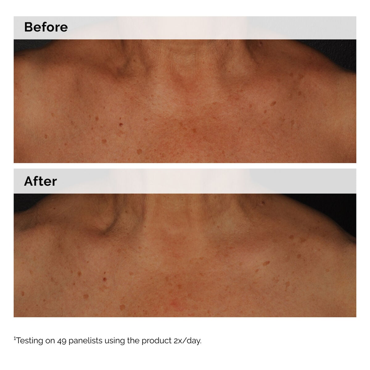 Niacinamide 5% Face and Body Tone-Evening Emulsion