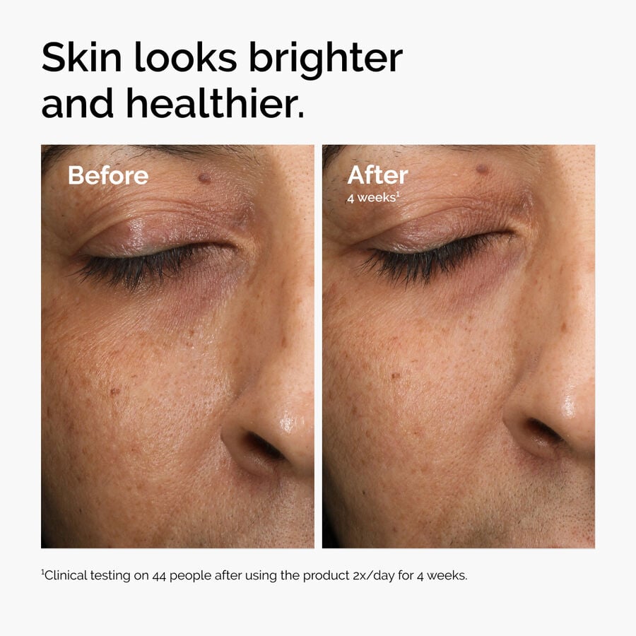 Multi-Antioxidant Daily Radiance Serum