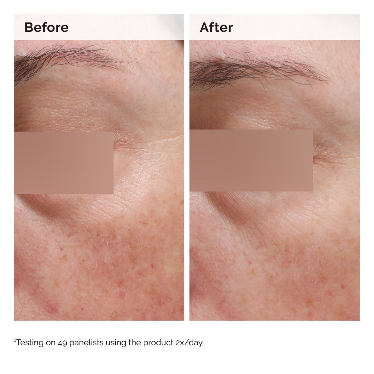 Niacinamide 5% Face and Body Tone-Evening Emulsion