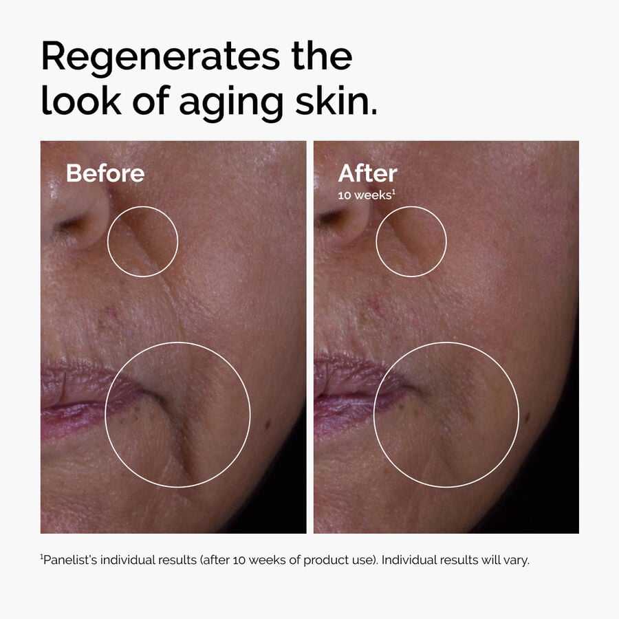 GF 15% Age-Support Serum