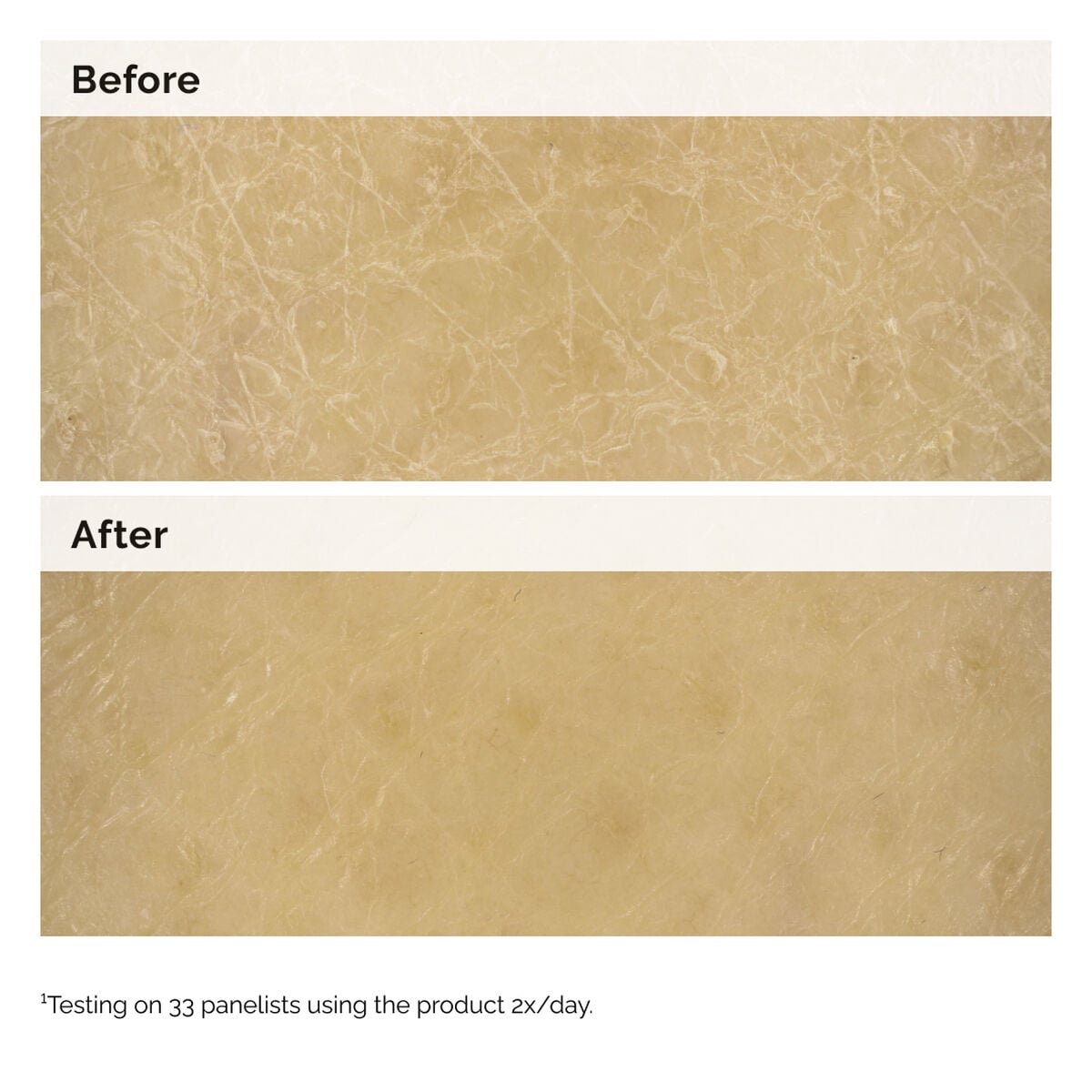 Natural Moisturizing Factors and Inulin Body Lotion