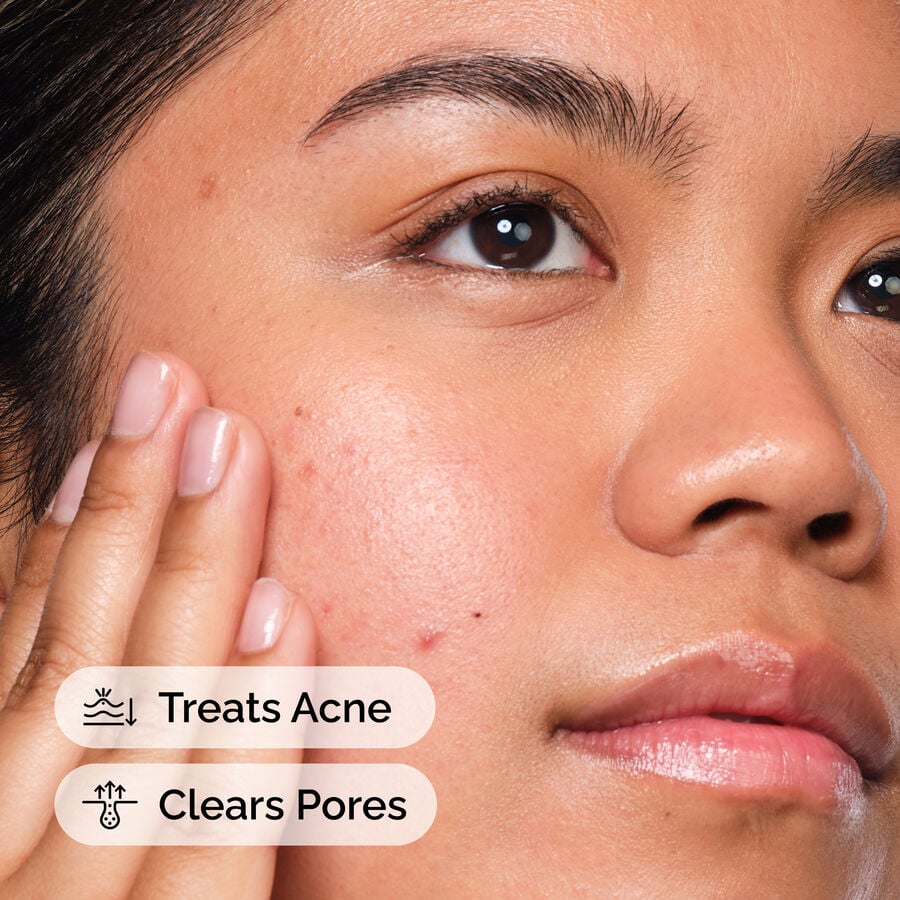 Salicylic Acid 2% Blemish-Targeting Serum