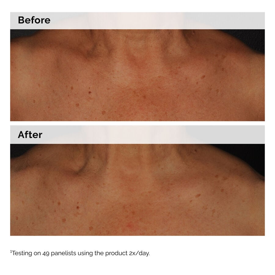 Niacinamide 5% Face and Body Tone-Evening Emulsion