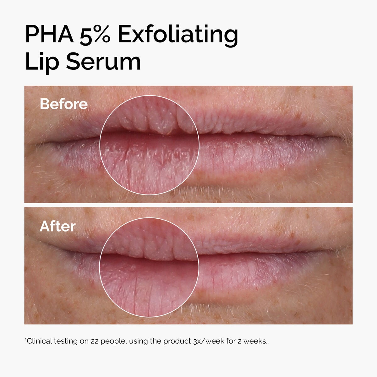PHA 5% Gluconolactone Exfoliating Lip Serum