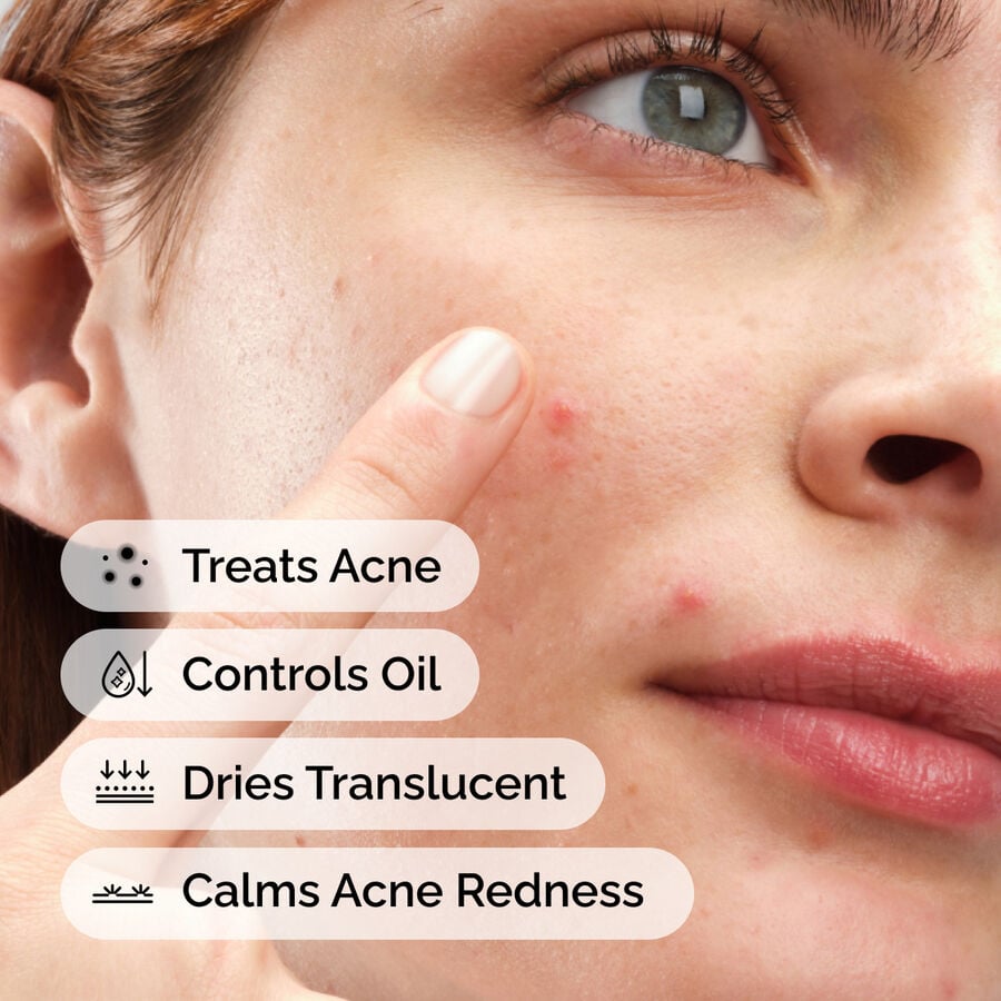 Sulfur 10% Powder-to-Cream Acne Treatment