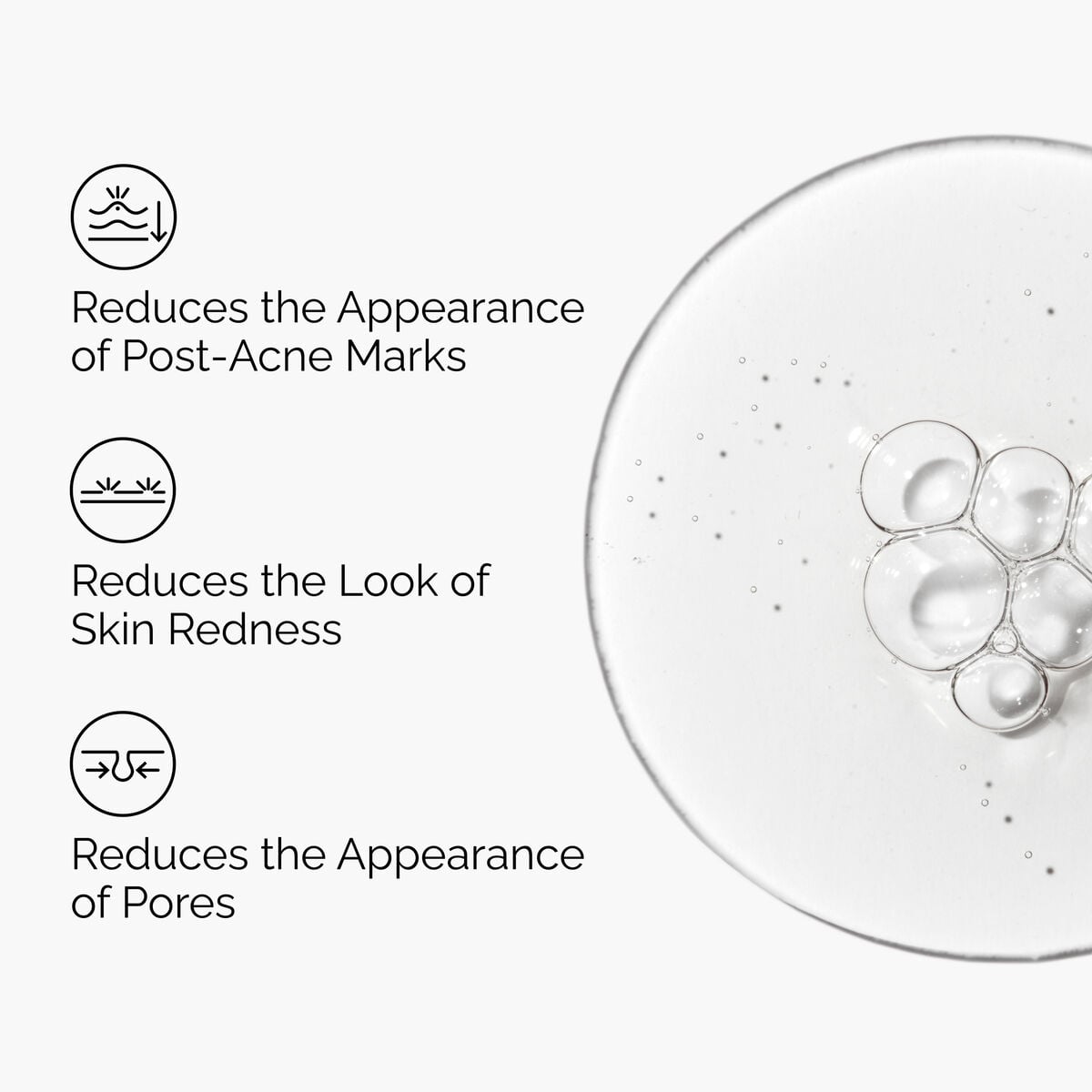 Aloe 2% and NAG 2% Serum for Post-Acne Marks